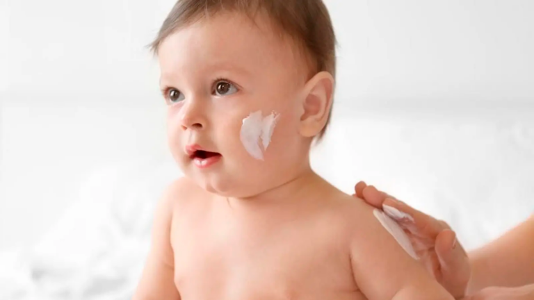 que es la dermatitis atopica